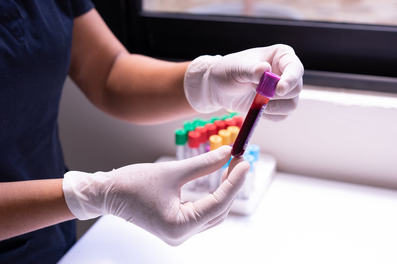 services-04 Gloved hands carefully handling a blood sample in a medical or laboratory environment.